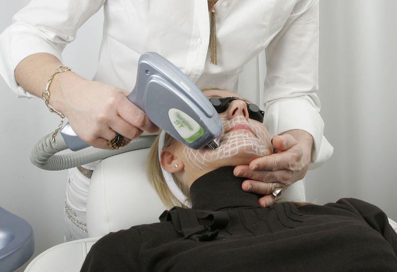 Frau wird mit Laser im Gesicht behandelt