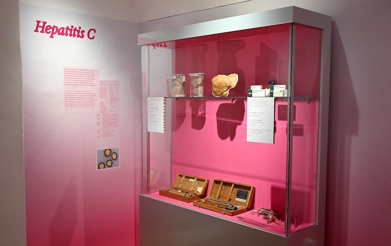 Ausstellung ‚Safe Sex: Comeback der Geschlechtskrankheiten‘ im Narrenturm Wien mit historischen Präparaten und Infotafeln zu STIs
